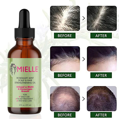 Rosemary Hair Growth Essential Oil ViralGalleria.com