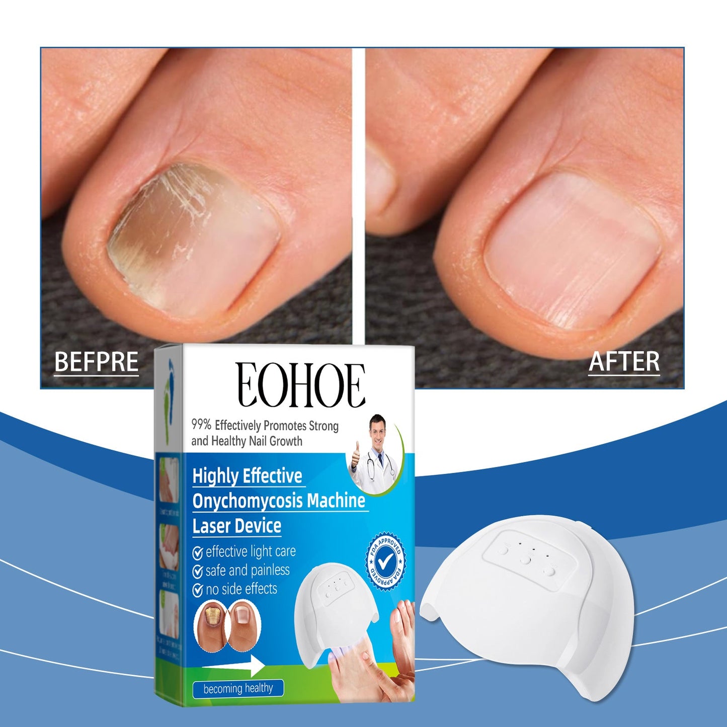 Eohoe Nail Care Instrument, Gentle Clean Nails Repair Hand, Foot And Finger Edge Rotten Nail Care Instrument