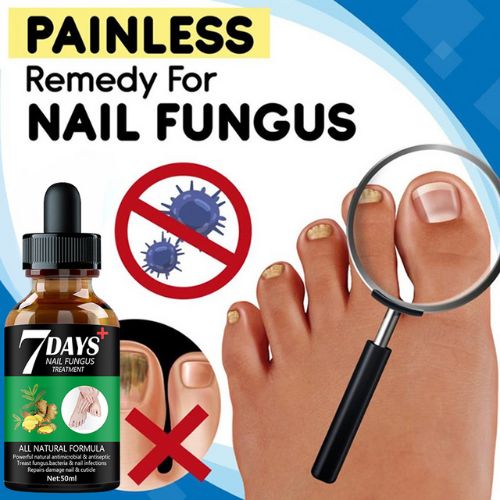 Foot Nail Fungus Treatment Serum ViralGalleria.com