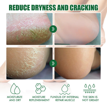 Chapped Heel Care Cream Repair Heel Peeling, Anti-Cracking And Moisturizing Foot Care Cream