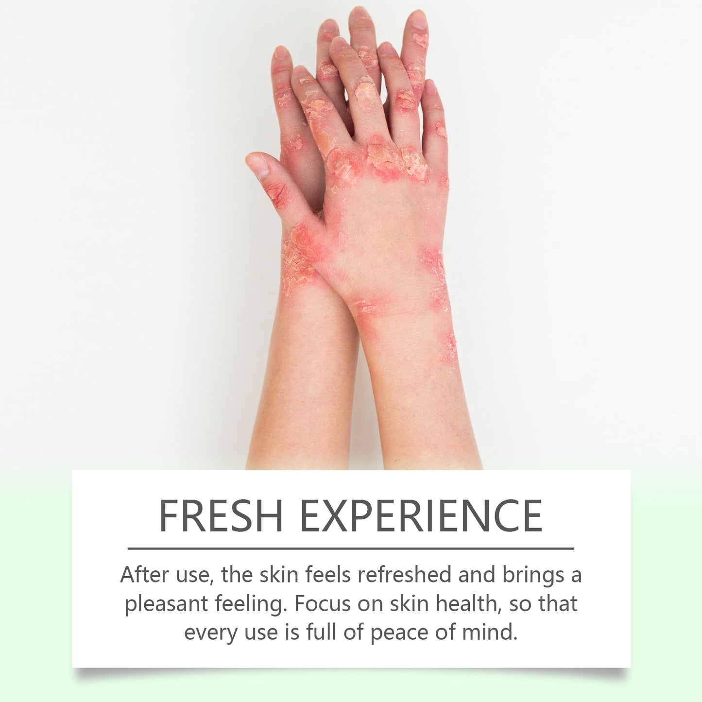 Herbal Skin Soothing Cream That Soothes And Nourishes Uncomfortable Skin With Body Skin Treatment Cream