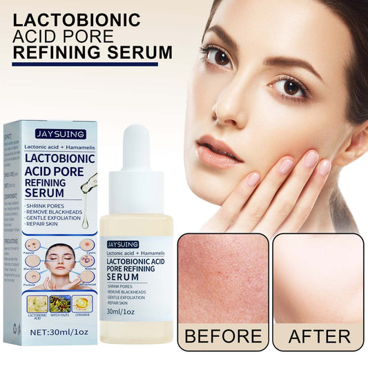Lactose Solution, Exfoliate Remove Blackheads Shrink Pores Clean And Moisturize SkinEssence V.I.P Digital Presence