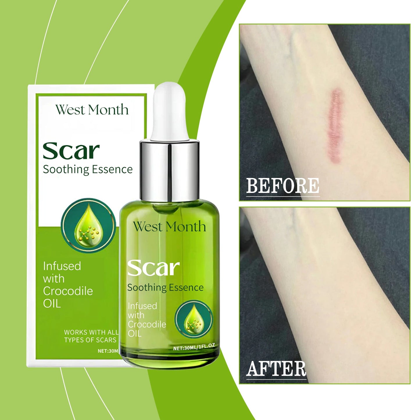 Skin Repair Essence, Body Skin Moisturizing, Firming And Rejuvenating Care Essence