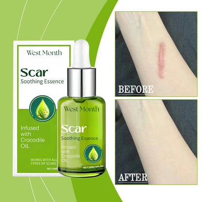 Skin Repair Essence, Body Skin Moisturizing, Firming And Rejuvenating Care Essence