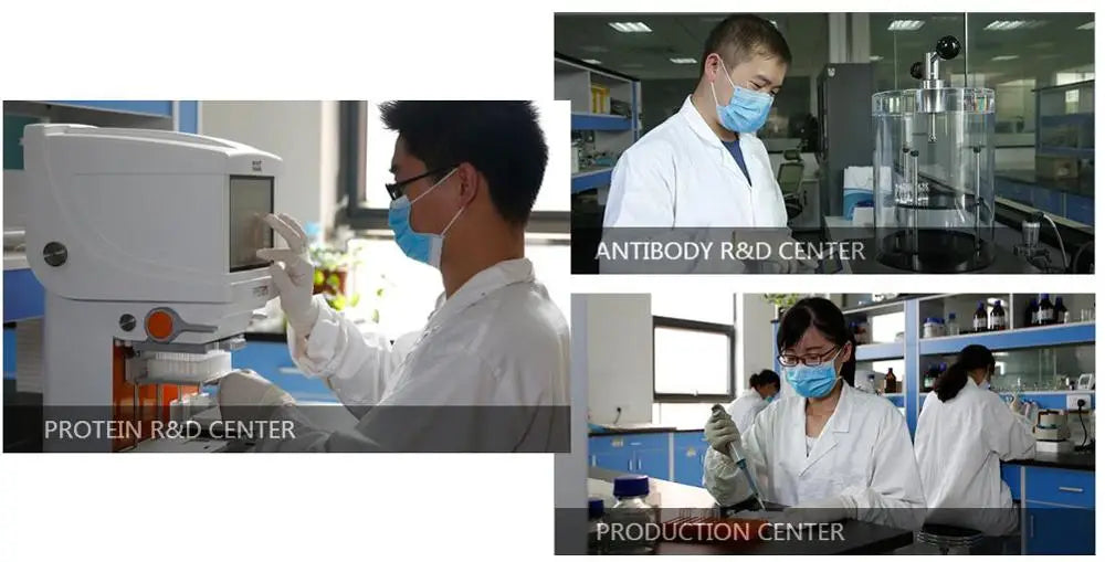 Human Ovarian Cancer Marker-CA125 ELISA Kit NovaCart