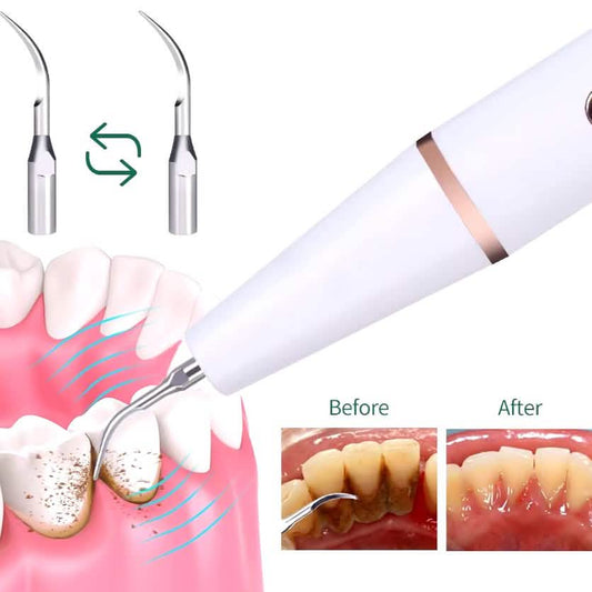Advanced Electric Teeth Cleaning Tool Powerful Calculus Remover & Tartar Eraser DailySale