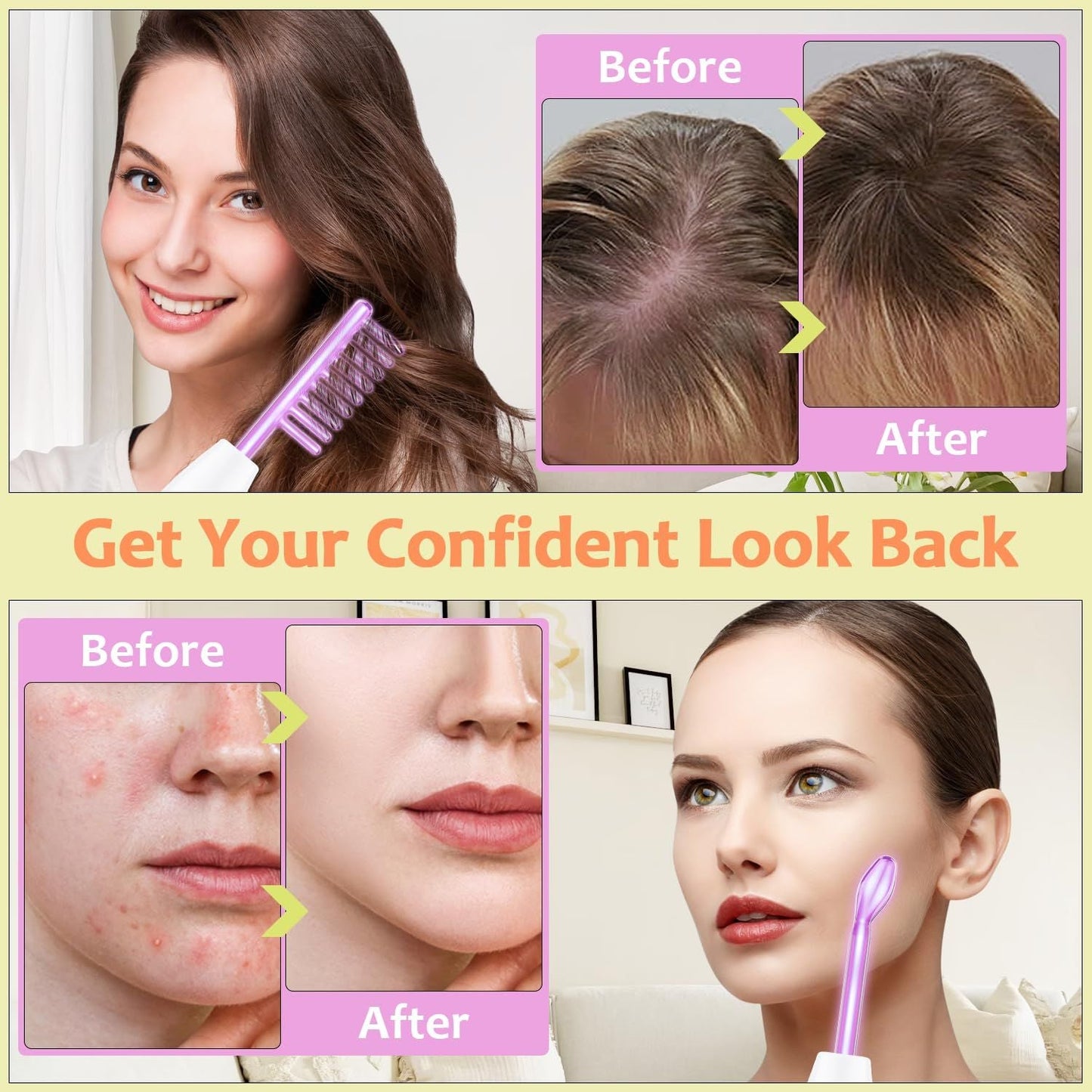 High Frequency Wand 'C Violet Portable Skin Therapy Machine for Anti-Aging - Skin Tightening - Wrinkle Reducing - Dark Circles - 4 in 1 New Era Fashion LLc