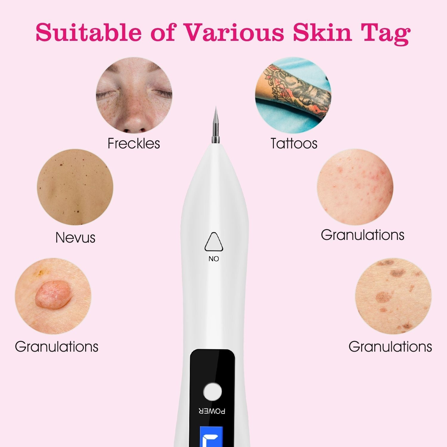 Skin Tag Repair Kit Portable Beauty Equipment Multi-Level with Home Usage USB Charging LCD Level Adjustable 6 Replaceable Needles New Era Fashion LLc