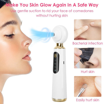 Blackhead Vacuum Remover Electric Acne Blackhead Comedone Extractor Remover Tool Facial Pore Cleaner Pimple Suction Tool New Era Fashion LLc