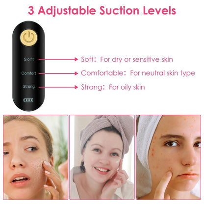 Blackhead Vacuum Remover Electric Acne Blackhead Comedone Extractor Remover Tool Facial Pore Cleaner Pimple Suction Tool New Era Fashion LLc