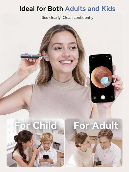 I35R Ear Cleaner with Flexible Ear Camera Otoscope - Visual Ear Pick Tweezers Wax Remover - Ear Cleaning Kit for Family New Era Fashion LLc