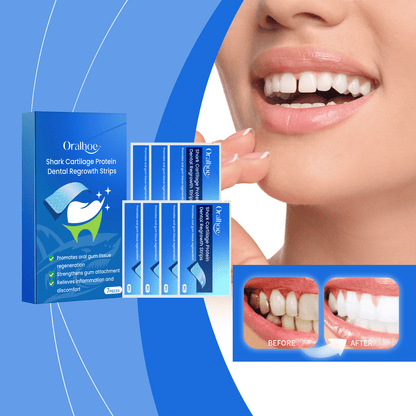 Oralhoe Dental Care And Strips For Stained Teeth New Era Fashion LLc