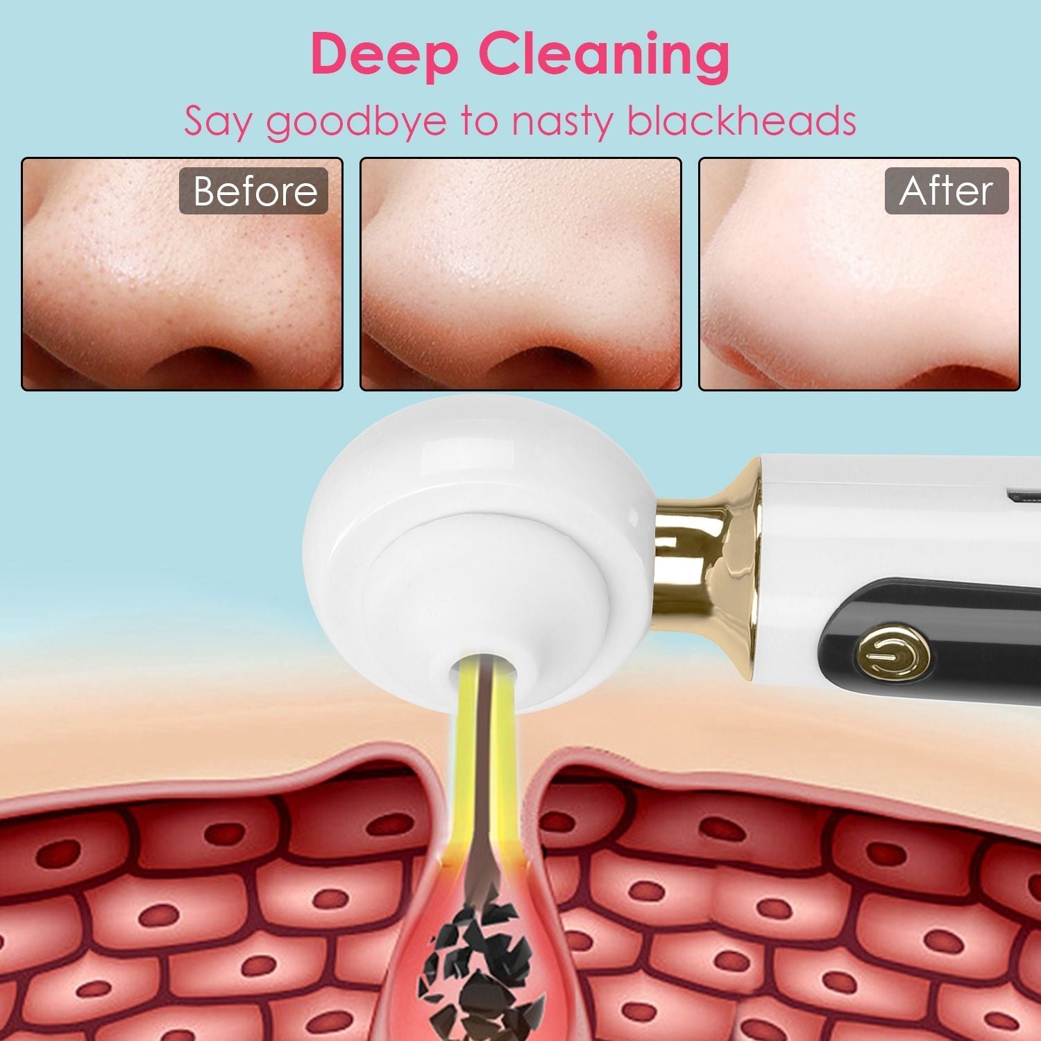 Blackhead Vacuum Remover Electric Acne Blackhead Comedone Extractor Remover Tool Facial Pore Cleaner Pimple Suction Tool New Era Fashion LLc