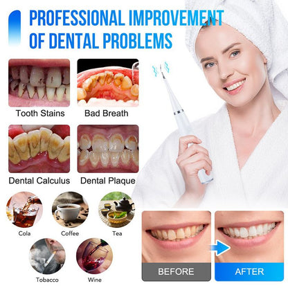 Ultrasonic Dental Scaler Teeth Whitening Electric Dental Calculus Remover Teeth Whitener Oral Care Ultrasonic Dental Cleaner New Era Fashion LLc