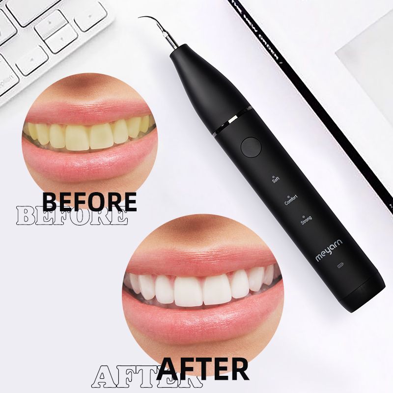 Sonic Electric Dental Plaque Remover New Era Fashion LLc